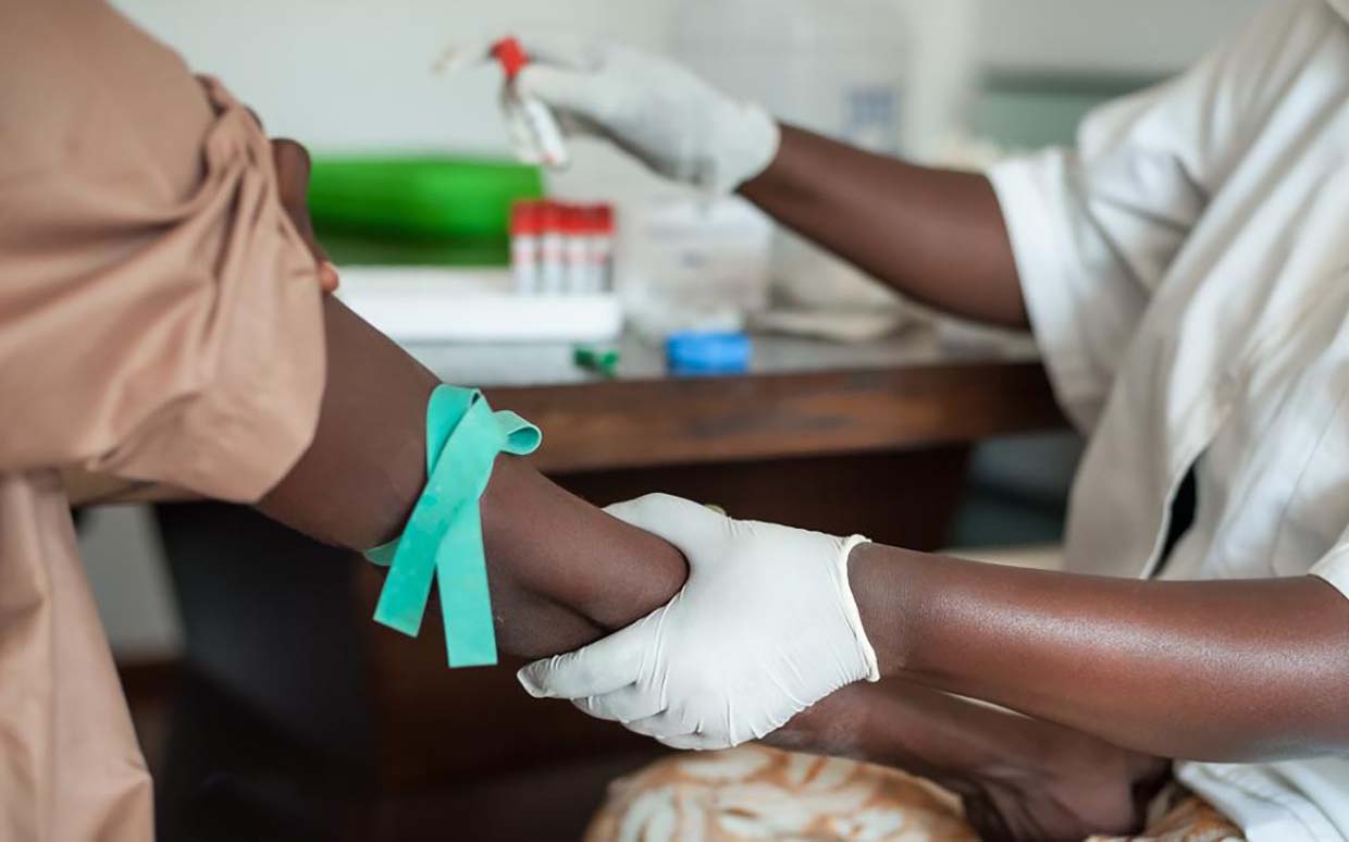 HIV AIDS